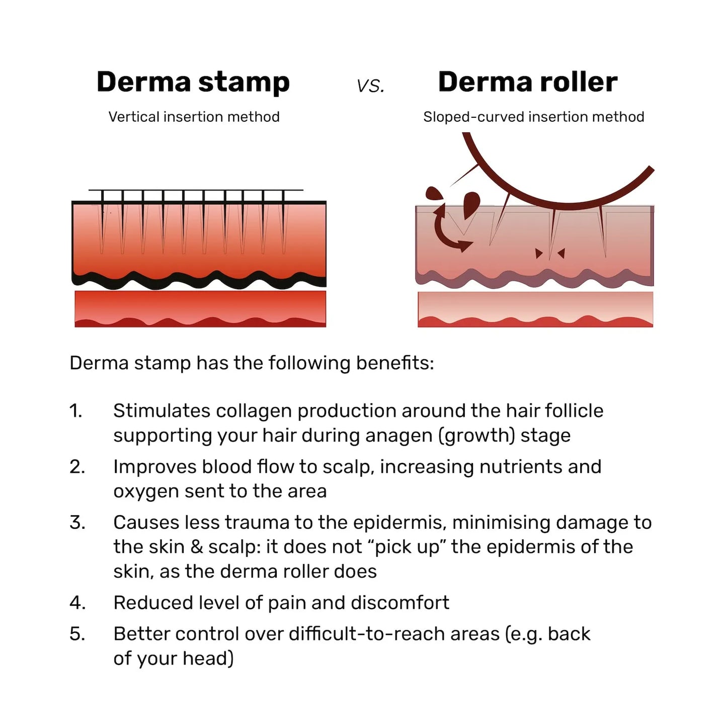 Derma Stamp  for Hair Growth